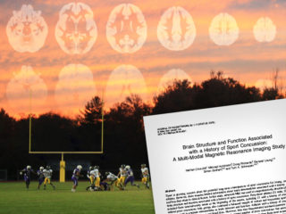 Image of a football game with concussion brain scans superimposed
